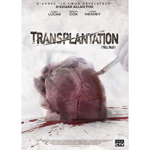 Transplantation