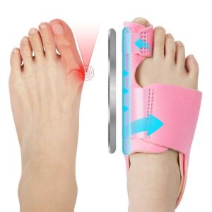 ACWOO Correcteur Hallux Valgus, Réglable Redresseur Orteil Utiliser Jour et Nuit, 2 x Ecarteur d'orteil Oignon 2 x Correcteur Silicone, Kit Oignon Pied Correcteur de Oignon pour Femmes et Hommes (AOGOE-EU, neuf)