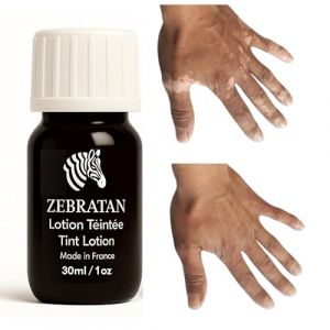 Lotion Maquillage Vitiligo 30 ml &ndash; Masque les Taches Blanches sur la Peau &ndash; Camouflage Naturel Non Gras pas un fond de teint &ndash; Hommes, Femmes & Enfants &ndash; Autobronzant, Vegan &ndash; Teinte marron profond (Zebratan, neuf)