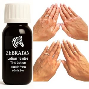 Lotion Maquillage Vitiligo 60 ml &ndash; Masque les Taches Blanches sur la Peau &ndash; Camouflage Naturel Non Gras pas un fond de teint &ndash; Hommes, Femmes & Enfants &ndash; Autobronzant, Vegan &ndash; Teinte beige marron (Zebratan, neuf)
