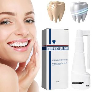Pulv&eacute;risateur dentaire Spray Calculusfree - Nettoyant pour tartre dentaire - Blanchisseur de dents - Rafra&icirc;chissant buccal - &Eacute;liminateur de tartre (1 pi&egrave;ce) (YANGYANGDEYIST, neuf)