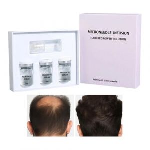 GkgWuxf Huiles Capillaires Fortifiantes, Huile Légère pour Cheveux, Hydratant Épaississant Extraits Végétaux Prévention Chute Soin Cuir Chevelu Hommes Adultes Cheveux Fins (qkufuey, neuf)