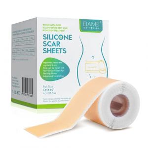 Moulis Pansement Silicone Cicatrice,Feuilles d'&eacute;limination des cicatrices en pour l'acn&eacute;, les ch&eacute;lo&iuml;des, br&ucirc;lures, le traitement chirurgicales c&eacute;sarienne(4X 150cm ) Beige (shaoshaoshop, neuf)