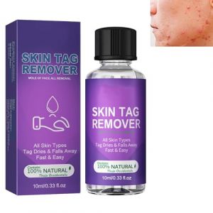 Liquide d'Élimination des Verrues Liquide Anti Verrues,Sérums d'Élimination Solution de Verrues Plantaire,Contre les Verrues/Corns/Soin des Pieds,Cryothérapie Verrue Plantaire,30ml (KENdouSHOP, neuf)