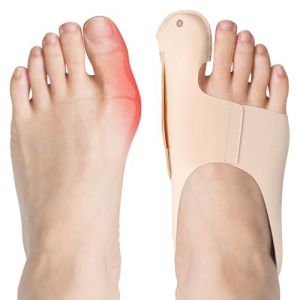 flintronic Correcteur Hallux Valgus, 2 x Ecarteur d'orteil Oignon, Gros Redresseur Orteil R&eacute;glable, Correcteur de Oignon pour Femmes et Hommes, Nuit & Jour R&eacute;glable, Beige L (flintronic, neuf)