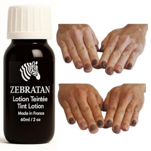 Lotion Maquillage Vitiligo 60 ml &ndash; Masque les Taches Blanches sur la Peau &ndash; Camouflage Naturel Non Gras pas un fond de teint &ndash; Hommes, Femmes & Enfants &ndash; Autobronzant, Vegan &ndash; Teinte marron moyen (Zebratan, neuf)