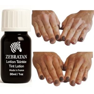 Lotion Maquillage Vitiligo 30 ml &ndash; Masque les Taches Blanches sur la Peau &ndash; Camouflage Naturel Non Gras pas un fond de teint &ndash; Hommes, Femmes & Enfants &ndash; Autobronzant, Vegan &ndash; Teinte marron moyen (Zebratan, neuf)