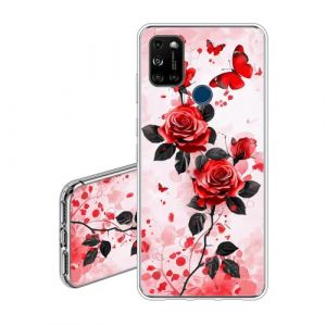 JEZSTHAI Coque Transparente Wiko View 5,Housse de Gel TPU Souple Ultra-Mince Antichoc,&Eacute;tui de Protection en Silicone Souple avec Design de Motif,Rose (KARSTHAI, neuf)
