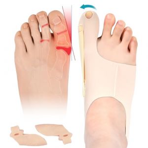 DGUSO 2 Pièces Hallux Valgus Correcteur Jour Nuit Orthese Hallux Valgus Bunion Corrector, Chaussettes Correctrices D'Oignons Correcteur Hallux Valgus Gros Redresseur Orteil Manchons de Protection (YELLOW FLYINGMAN LIMITED, neuf)