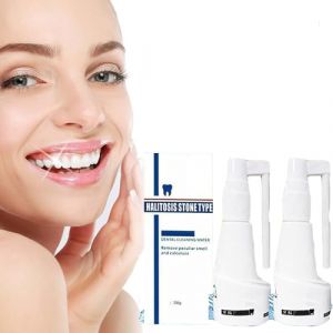 Spray dentaire &agrave; dissolution Calculusfree, spray de nettoyage pour le tartre des dents, spray de blanchiment des dents, spray rafra&icirc;chissant pour la bouche pour les dents, dissolvant de tartre (2 (YANGYANGDEYIST, neuf)