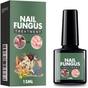 Solution contre la Mycose des Ongles - Traitement Efficace - 40ml (lkjhxg, neuf)