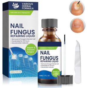 Traitement Mycose Ongles Des Pieds Traitement Ongles Solution Pour Les Ongles DécolorésÉpaissisÉmiettésSoin Professionnel Pied