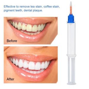 minifinker Gel de blanchiment dentaire 5ml 35% peroxyde dhydrogène Double baril blanchiment dentaire soins hygiene dentaire