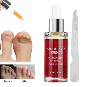 Solution réparation dongles puissante 15ML - DRFEIFY - Soin efficace contre la mycose des ongles