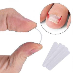 10pcs Incarné Ongle Pédicure Ensemble - Clip De Redressement & Attelle Courbée Pour Paronychia Épais - Neuf