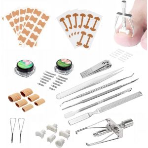Incarn&eacute;s Pieds Outil, Ensemble D'outils Pour Ongles Incarn&eacute;s Correcteur D'ongles Incarn&eacute;s Ensemble D'outil Ongle Incarn&eacute; Pour Le Traitement Paronychia Ongles Incarn&eacute;s Prot&egrave;ge Les Ongles - Neuf