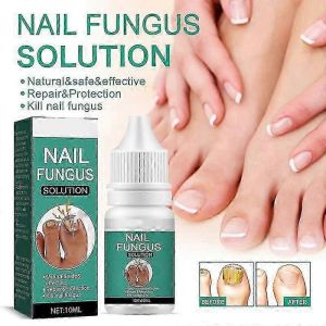 Traitement Fongique Des Ongles Pour Ongle Extra Fort,Traitement Des Ongles Incarnés Huiles De Soin Des Ongles,Toenail Fu - Neuf