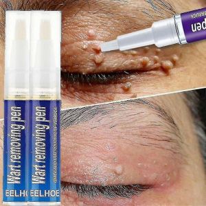 Stylo Anti-Verrues, Dissolvant De Grains De Beauté, Élimine Les Verrues De Maïs Des Pieds, Crème De Traitement (2 Pièces) - Neuf