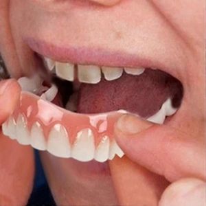 Facettes Dentaires Orthodontiques - Silicone Adhésif Doux Et Sûr - Teinte Blanche Extra Fine - Peau De Prothèse Dentaire Pour Le Confort Des Appareils Orthodontiques - Neuf