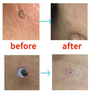 Lot de 10 pinces à sachets, pinces à chips, pinces alimentaires, trombones, robustes, hermétiques, pratiques pour la maison et le bureau, 7,6 cm de large, en acier inoxydable - Neuf