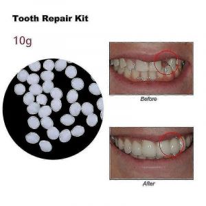 Colle Adhésive Dentaire En Résine 30-50g Pour Prothèses Temporaires Et Réparation De Fausses Dents - Neuf
