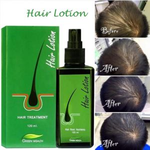 Lotion Capillaire Green Wealth 120 Ml, Traitement Pour La Croissance, La Racine, La Perte De Cheveux Et Les Favoris - Neuf