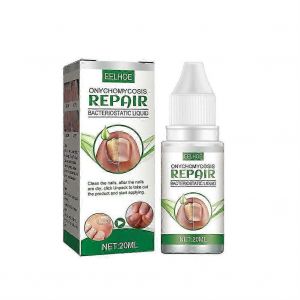 20ml Liquide De Traitement Fongique Des Ongles Très Efficace Tue La Réparation Des Champignons Des Ongles Des Orteils - Neuf