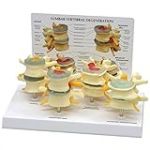 GPI Anatomicals 1760 Jeu de modèles de vertèbres 4 stades